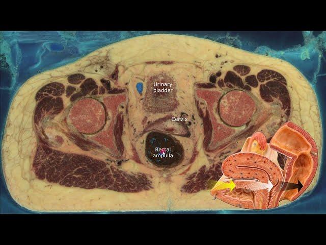 Cross sectional anatomy of the female pelvis