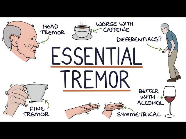 Understanding Benign Essential Tremor