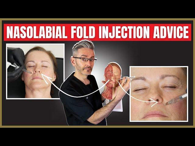 Nasolabial fold injection advice. | Botox vs Filler