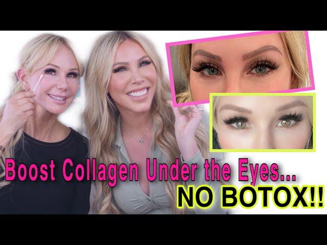 How to BOOST COLLAGEN UNDER the EYES NATURALLY | DO'S and DON'TS