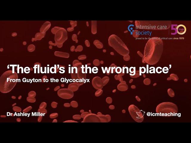 Fluids in the wrong place - from Guyton to the glycocalyx