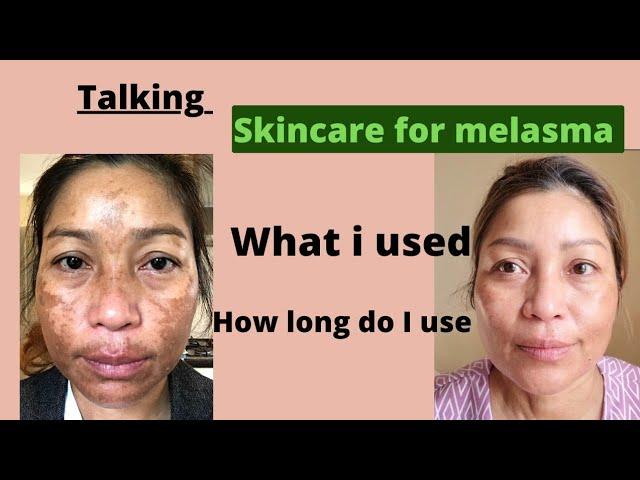 Talking my Skincare for Melasma and Darkspot with Eucerin and how long do I use