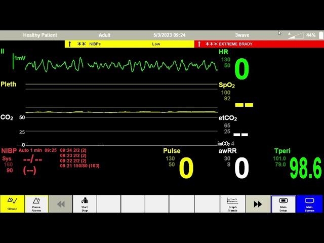 Anesthesia Scenario