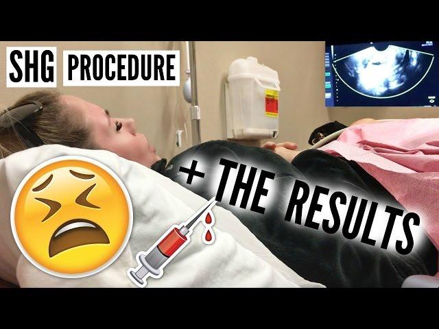 MY SHG PROCEDURE & THE RESULTS