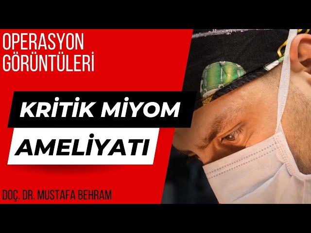 Miyom Ameliyatı Operasyon Görüntüleri | Riskli Hasta için Operasyon Süreci #jinekoloji #jinekolog