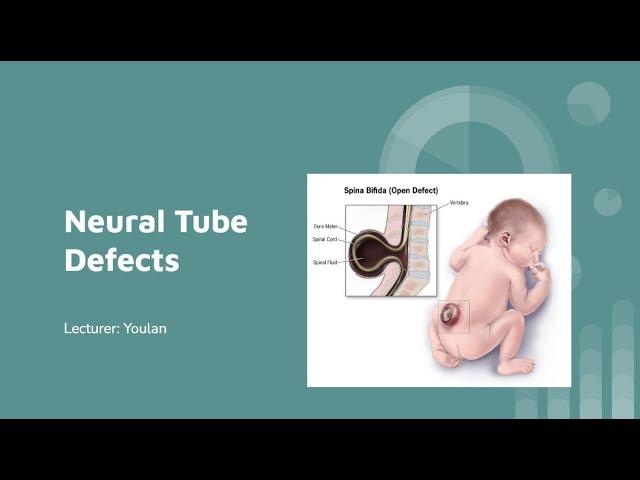 Neural Tube Defects: Developmental Process, Types, Risk Factors