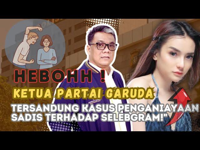 HEBOH! Ketua Partai Garuda Aniaya Selebgram Cantik? Kasus Mengejutkan Guncang Dunia Politik! #nabila