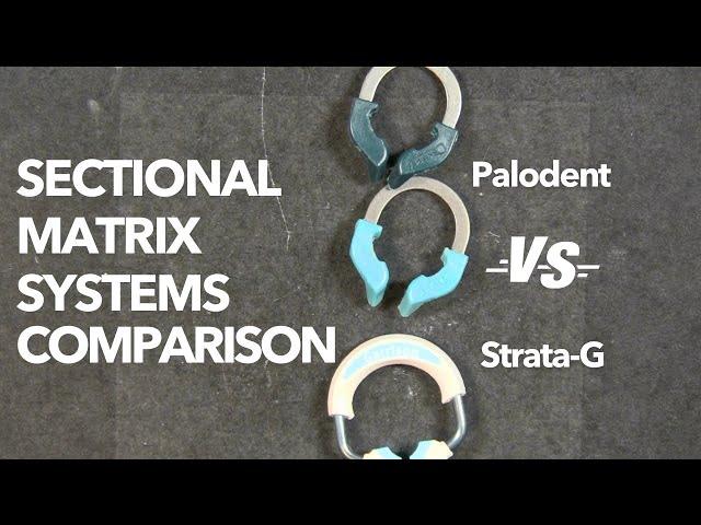 Sectional Matrix System Comparison