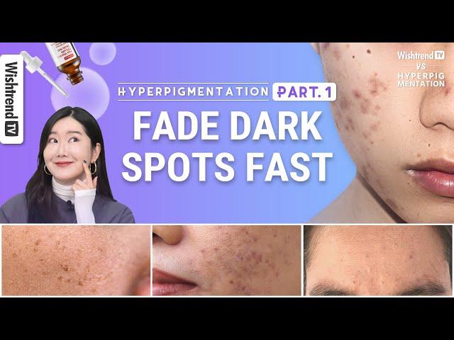 How to Get Rid of Hyperpigmentation, Brightening Skincare Routine | Fade Face Dark Spots Fast part.1