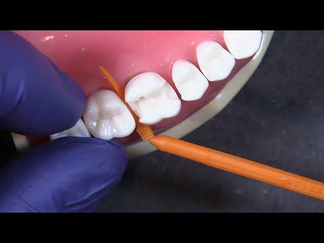 The Wedge Wands® by Garrison Dental