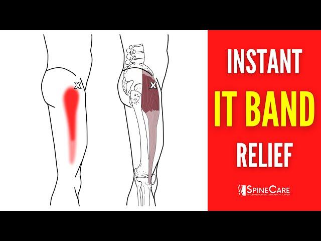 How to Relieve Iliotibial Band Pain FOR GOOD