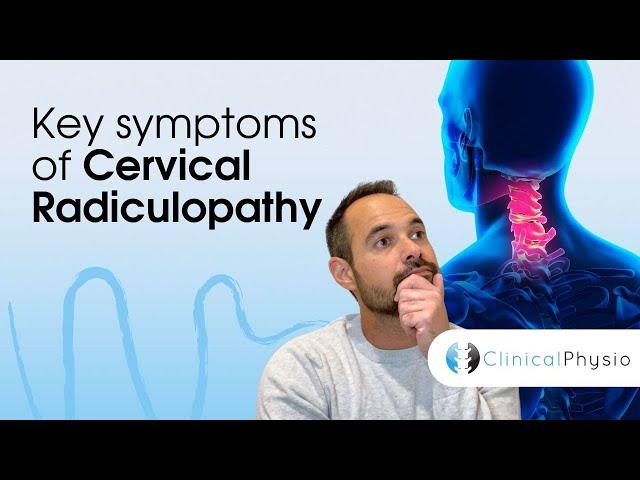 Key Symptoms of Cervical Radiculopathy | Expert Physio Guide