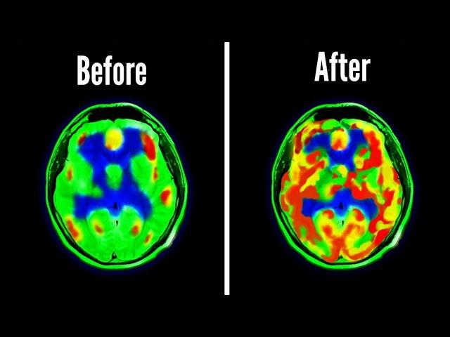 How Dopamine Detoxing Changed My Brain