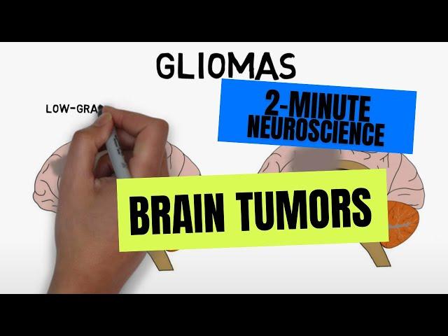 2-Minute Neuroscience: Brain tumors