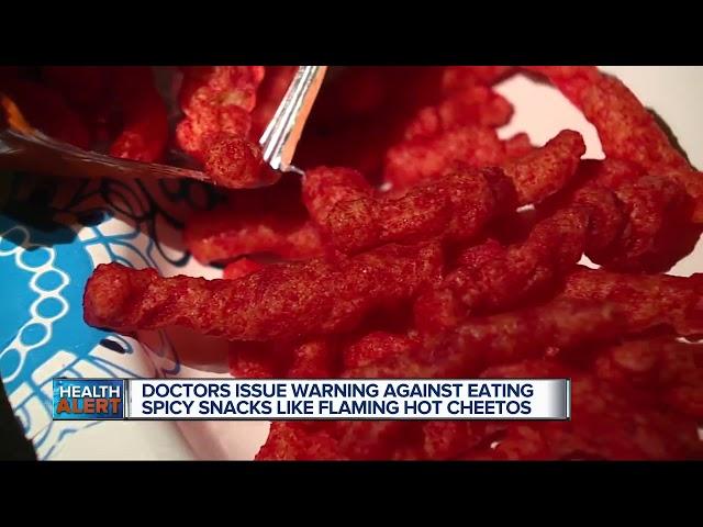 Doctors issue warning against eating spicy snacks like Flaming Hot Cheetos