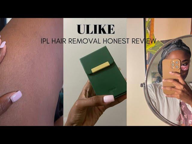 IPL AT HOME LASER HAIR REMOVAL | Final Review