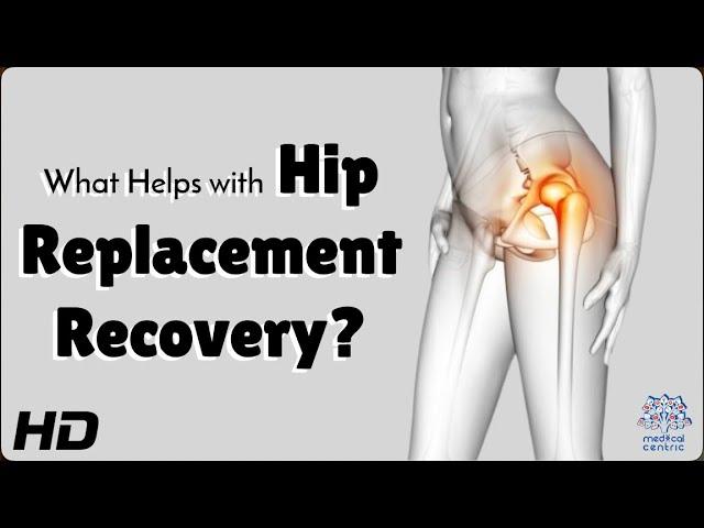 Hip Replacement Recovery: Do This, Not That!