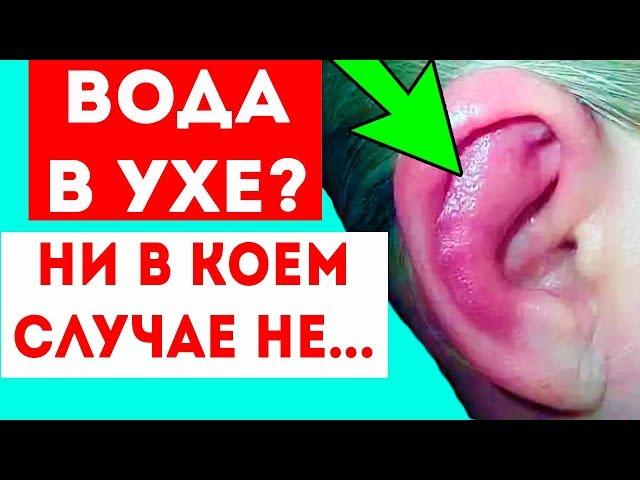 ЧТО ЕСЛИ ВОДА ПОПАЛА В УХО? 8 способов убрать воду из уха! И что нельзя делать