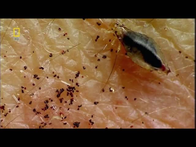 Нательная вошь (Pediculus corporis) под микроскопом