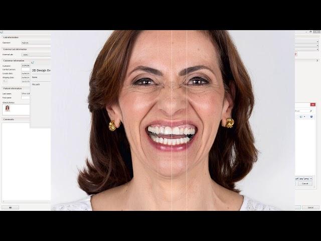 3Shape Dental System Smile Design アプリケーションと RealView エンジンを使用して設計する方法