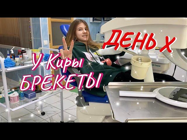 ВЛОГ: День Х. Кире установили брекеты.