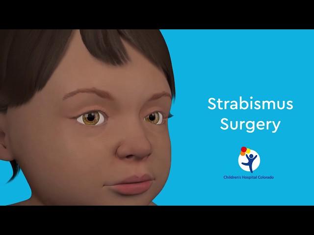 What is Strabismus Surgery?