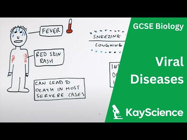 Viral Diseases Explained - GCSE Biology | kayscience.com