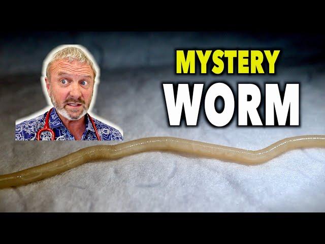 WE FOUND A WORM IN HIS RECTUM... (What Type Could It Be?) | Dr. Paul