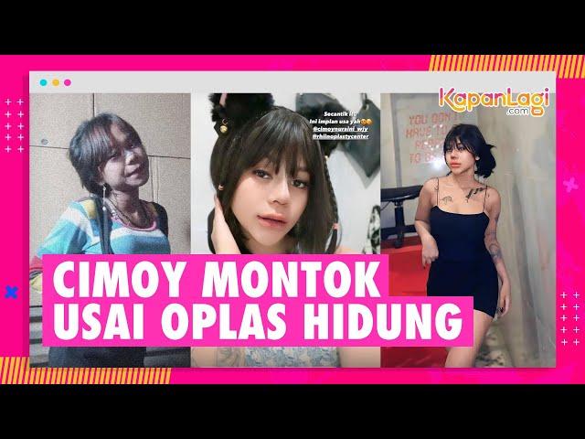 Kabar Terbaru Cimoy Montok Usai Oplas Hidung, Disebut Makin Cantik Hingga Mirip Ivan Gunawan