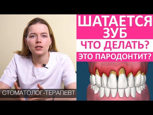 Шатается зуб. Что делать? Пародонтит: причины, последствия, лечение. Расшатывание, подвижность зубов