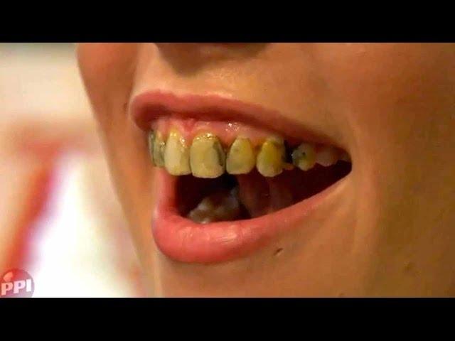 How To Stain Your Teeth With Fleet Street Pegworks Tooth Lacquers