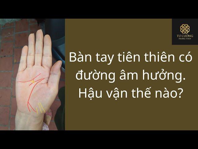 Đường âm hưởng trên bàn tay tiên thiên. Hậu vận thế nào? [Xem chỉ tay]