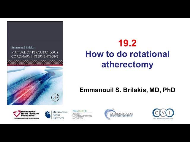 19.2 Rotational atherectomy: Manual of PCI