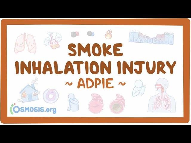 Smoke inhalation injury: Nursing Process (ADPIE)