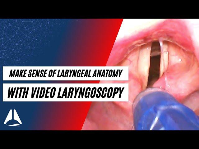 How to make sense of laryngeal anatomy with a video laryngoscope | ABCS of Anaesthesia Foundations