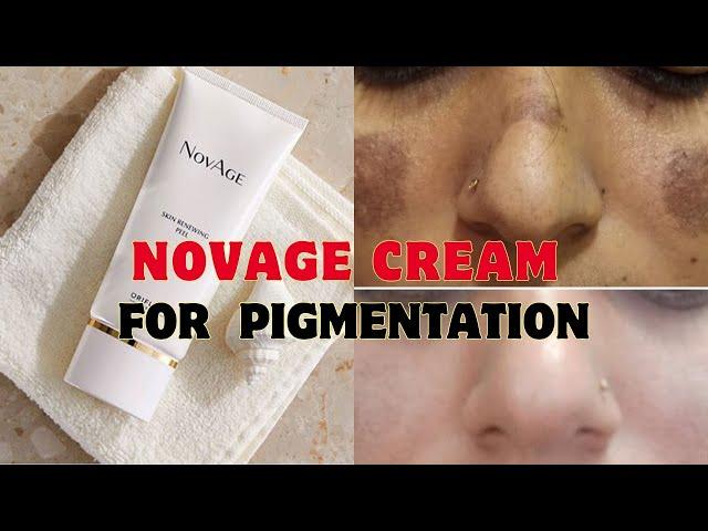 Novage cream for pigmentation | Reviews | Oriflame products