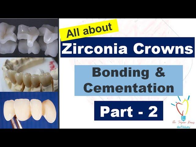 Zirconia Crowns - CEMENTATION vs BONDING.