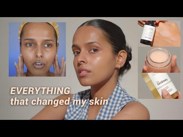 My Skincare Journey- Everything I did for even skin tone