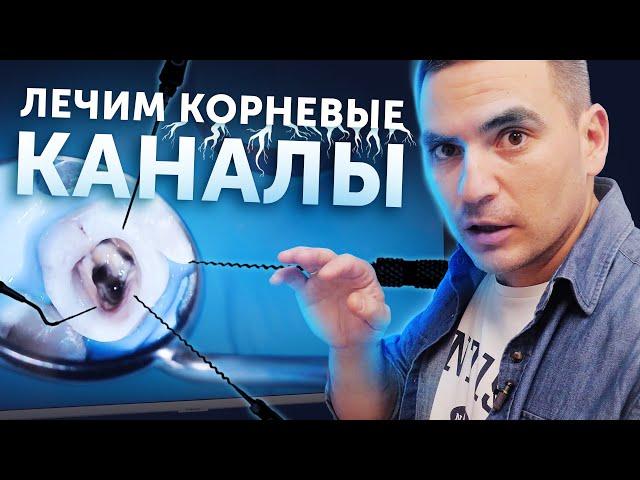 Лечение корневых каналов зуба | Процедура под микроскопом