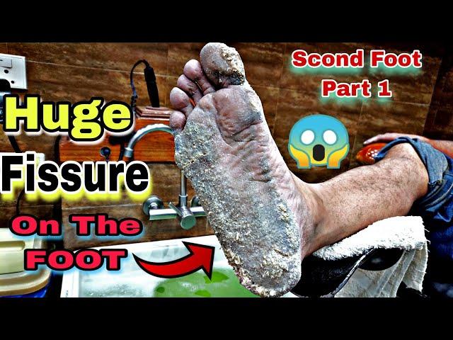 Smart Footcare pedicure & Manicure Funky skin Pedicure in Footcare33