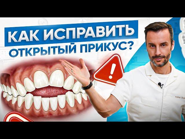 Открытый прикус ДО и ПОСЛЕ. Причины, последствия и лечение открытого прикуса