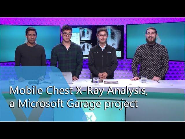 Mobile Chest X-Ray Analysis, a Microsoft Garage project | The Xamarin Show