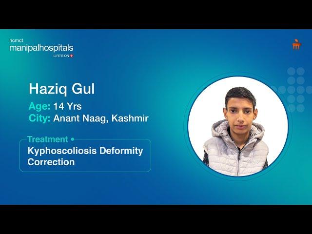 Kyphoscoliosis | Dr. Hamza Shaikh | Manipal Hospital Delhi