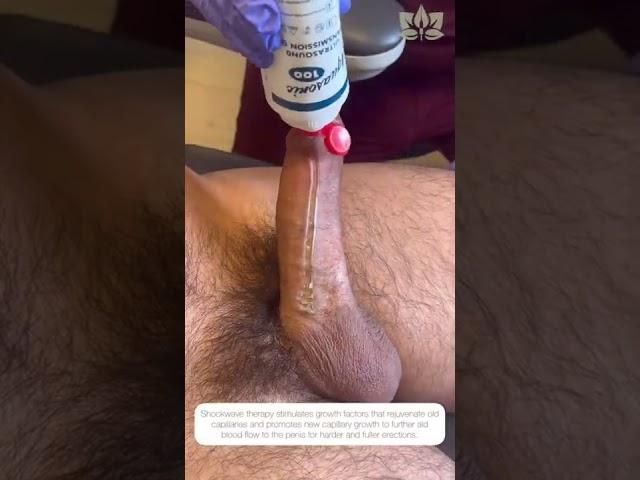 Penis Shockwave Therapy for Harder Erections