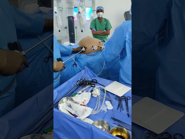 Inserting a 15 cm mesh in Robotic TARUP Surgery for Umbilical Hernia #drvishalsoni