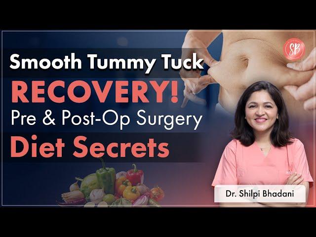 Tummy Tuck Prep | Post Tummy Tuck Recovery | What to Eat After Tummy Tuck Surgery? | SB Aesthetics