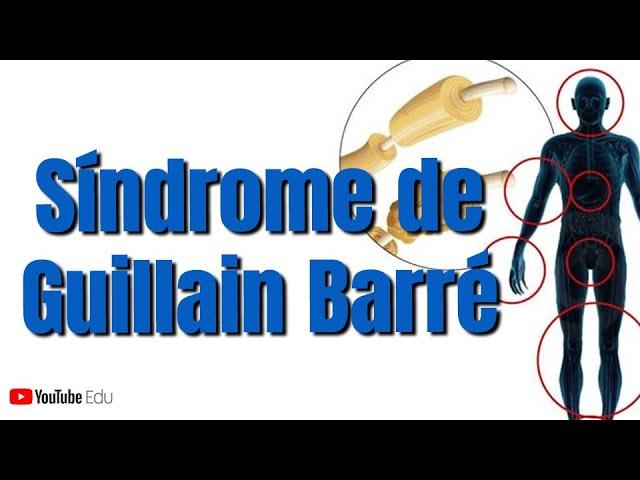 Síndrome de Guillain Barré (Subtipos, Quadro Clínico e Fases)