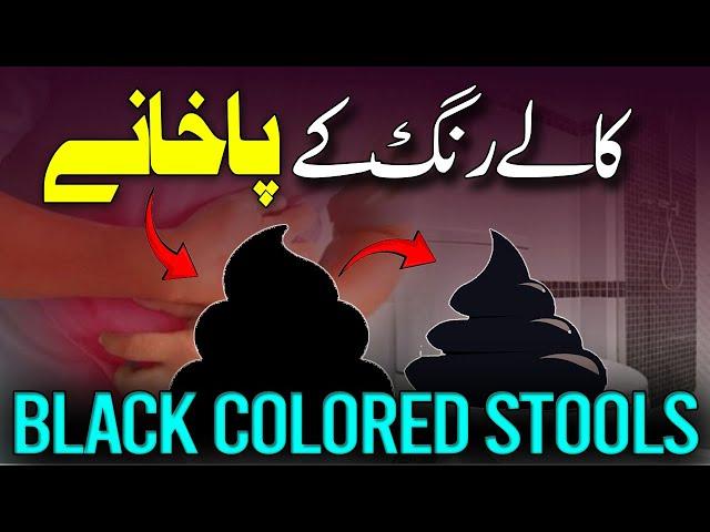 Black Colored Stools | کالے رنگ کے پاخانےؔ  | The Medbros | Liver Disease |