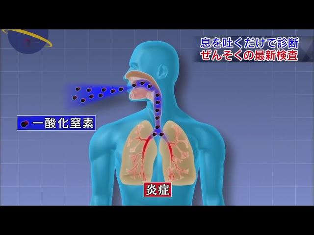 治る最前線「大人のぜんそくの最新治療」