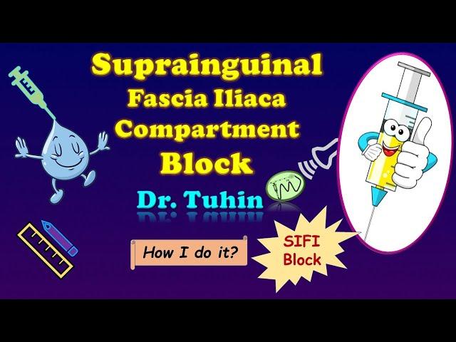 Ultrasound Scanning Principles for Suprainguinal Fascia Iliaca block | SIFI Block | S-FICB